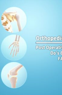 Post Operative Instructions | Do’s & Don’ts | FAQ’s for Orthopedic Treatment | Sri Hospitals Chennai