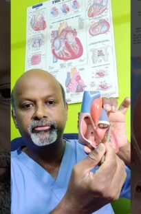 Dr Prem Sekar explains Device Closure Procedures for Simple holes in the Heart.